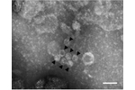 Viry Snímek z elektronového mikroskopu, zachycující pravděpodobné částice jednoho ze tří objevených virů.