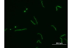 Borrelia Bacteria of the genus Borrelia in the microscope. Photo: Archive of the Biology Centre CAS