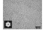 Částice hexameru proteinu helikázy P4 Jednotlivé částice hexameru proteinu helikázy P4 (210 kDa, 6 nm) kontrastované uranyl acetátem. Vlevo dole 2D single particle analýza této částice.