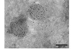 Immunolokalizace proteinu pomocí protilátky konjugované s koloidním zlatem.  Immunolokalizace proteinu pomocí protilátky konjugované s koloidním zlatem. 