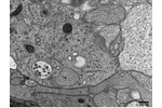 Ultrastructure of neurocytes. Ultrastructure of neurocytes.